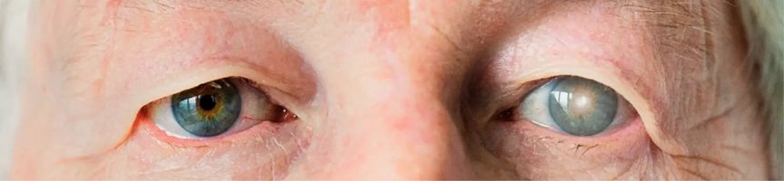 Vision warning